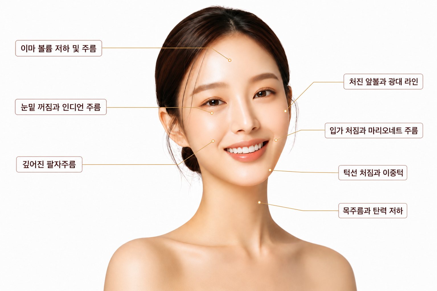 얼굴 부위별 매선 리프팅 고민 지점